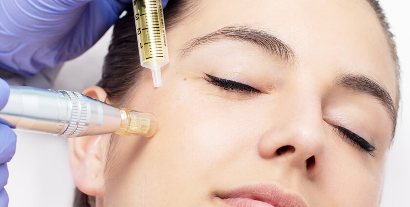 How Mesotherapy Helps with Acne Scarring