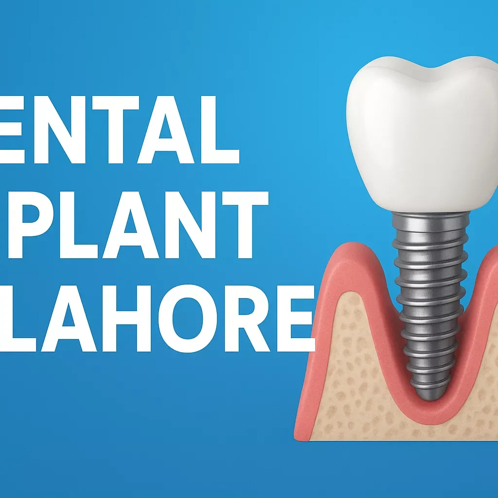 Dental Implant in Lahore