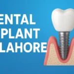 Dental Implant in Lahore