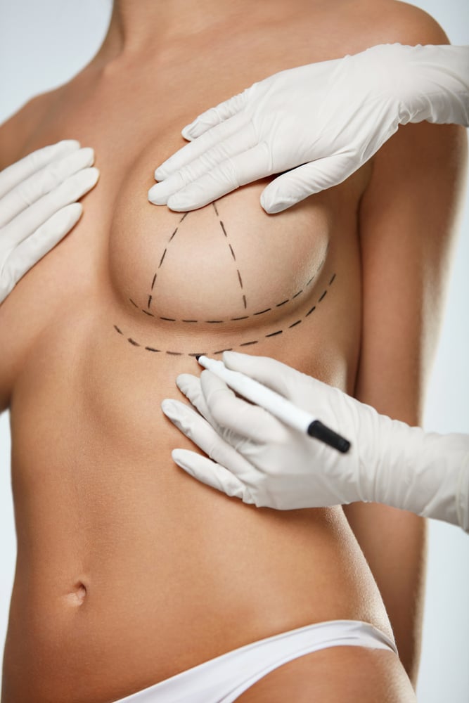Breast Lift Surgery That Boosts Confidence