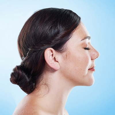 Can Laser Skin Tightening Treat Loose Body Skin