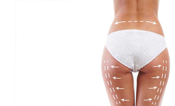 Does Thigh Lift Help With Asymmetrical Thighs