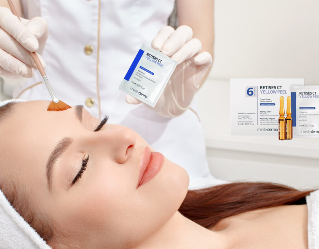 Gentle Yet Powerful Yellow Peel Treatment