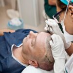Hair Transplant Procedure: Step-by-Step Guide for Beginners