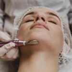 How J Plasma Skin Resurfacing Renews Collagen