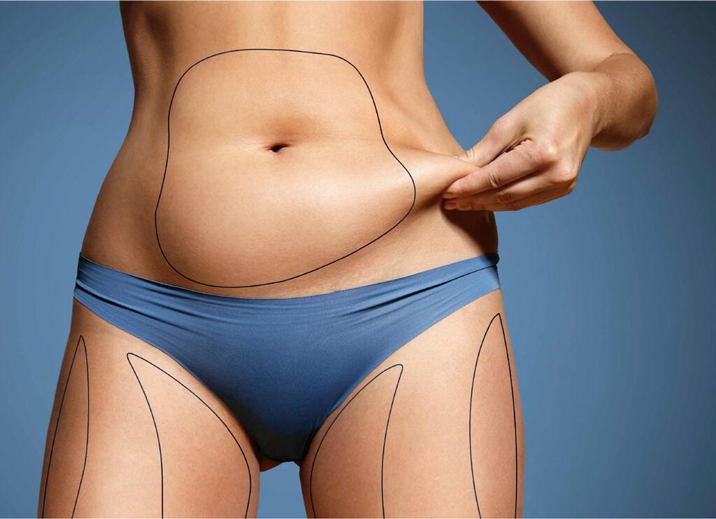 How Tummy Tuck Improves Core Muscle Strength