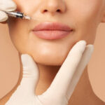 Lip Filler Hacks for the Perfect Pout