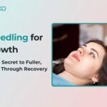 Microneedling-for-Hair-Growth