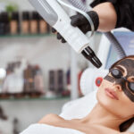 Non Surgical Skin Brightening with Laser Carbon Peel