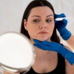 Polynucleotide Treatment