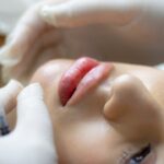 Smooth and Sculpt with Voluma Fillers