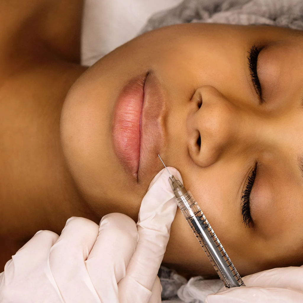 Volift Fillers for Refreshed and Youthful Appearance