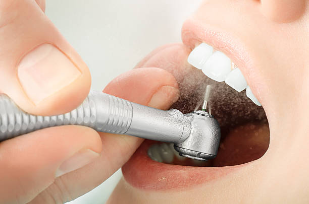 What Are the Benefits of Regular Teeth Cleaning