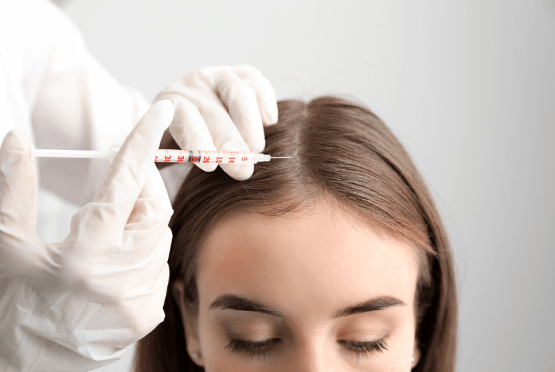 What Makes Exosome Therapy for Hair Loss Effective