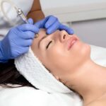 Best Microdermabrasion in Islamabad for Skin Beauty
