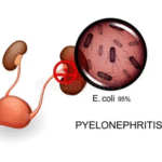 Vasectomy and Procedural Ethics: Teaching Informed Consent and Autonomy