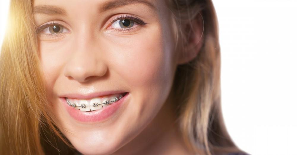 Dental Braces and Oral Hygiene Best Practices