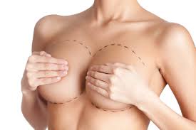 A Modern Path to Fuller Proportions with AFT Breast Augmentation