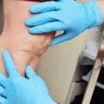 Advanced Care for Complex Vascular Conditions