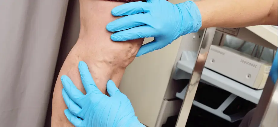 Advanced Care for Complex Vascular Conditions