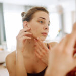 Can Acne Scar Treatment Fade Dark Spot Scarring