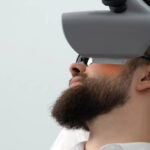 Can Beard Laser Hair Removal Help Patchy Beards