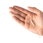 Can Contraception treatment Help Family Planning Goals