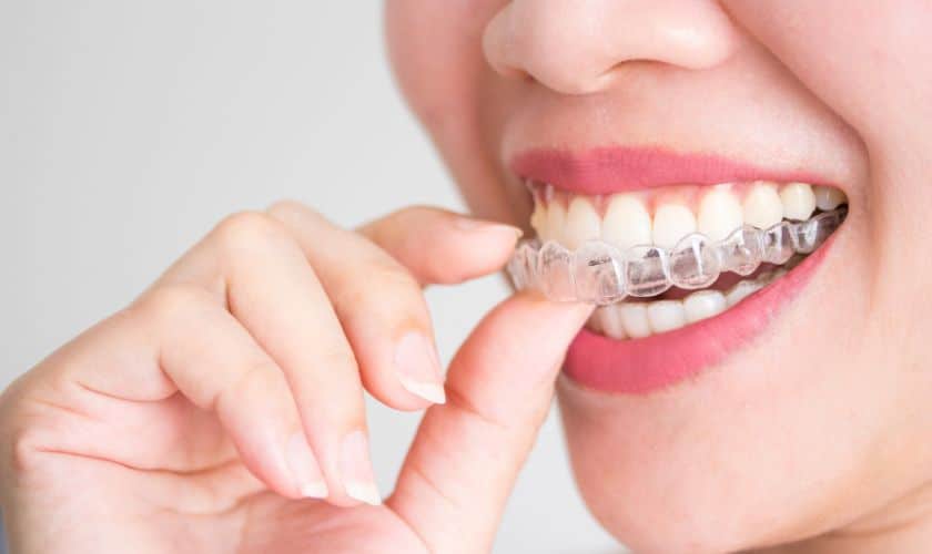 Invisalign Braces Treatment Cost: Tips for Choosing the Right Provider