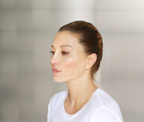 Can Thread Lift Improve Loose Neck Skin