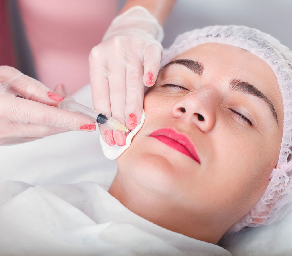 Define Your Mid Face with Cheek Fillers