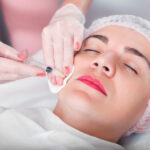 Define Your Mid Face with Cheek Fillers