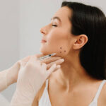 Does masseter botox create a V-shaped face