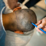 How Does GFC Treatment for Hair Improve Growth Fast