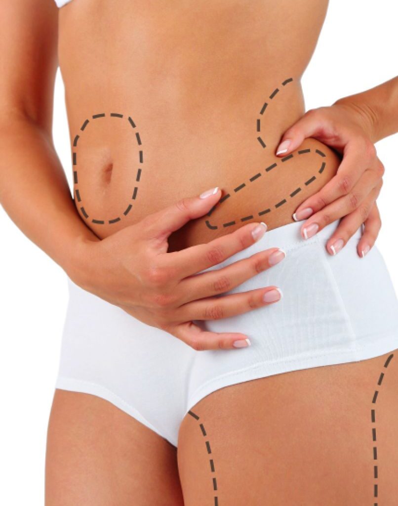 How Does Vaser 4D Liposuction Transform Body Contours?