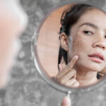 How Does the Best Dermatologist Treat Dark Spots