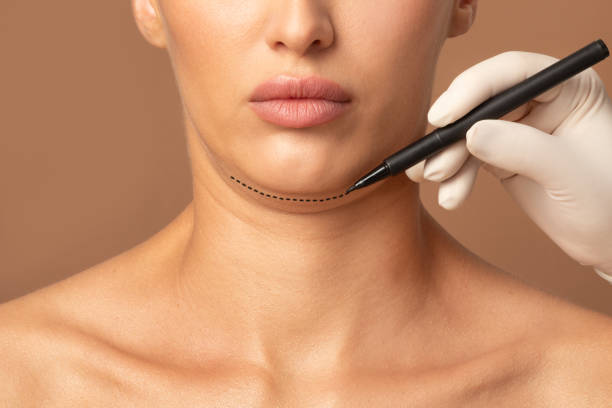 How Double Chin Removal Reduces Excess Fat Safely