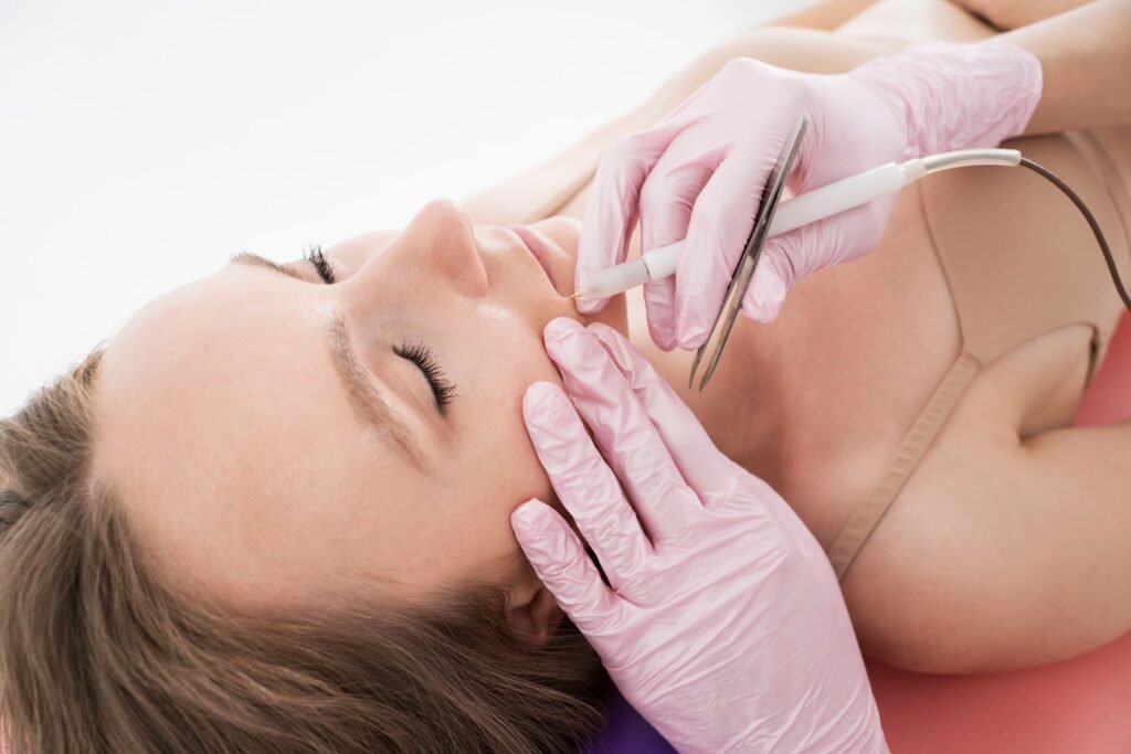 How Electrolysis Laser Hair Removal Works on Fine Hair
