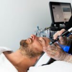 How Hydrafacial for Men Improves Overall Glow