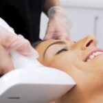 How Many Sessions Does Laser Acne Scar Treatment Need