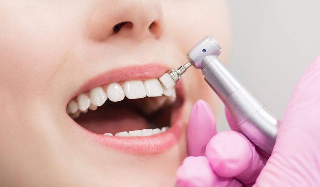 How Often Should You Get Professional Teeth Cleaning?