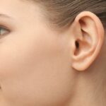 How Otoplasty Refines Ear Contours