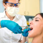 How Painful Is Tooth Removal for Adults