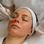 How Safe Is Inno Peel for Facial Skin