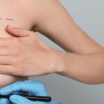 How to Prepare for Breast Augmentation Surgery
