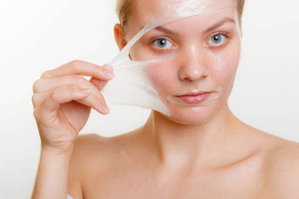 Is Chemical Peel Safe for Darker Skin