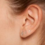 Is Ear Piercing Safe for People With Skin Conditions