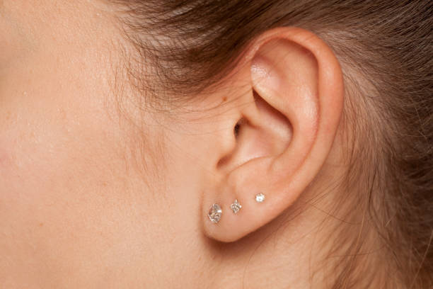 Is Ear Piercing Safe for People With Skin Conditions