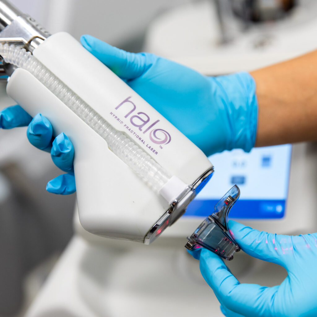 Is Halo Treatment Effective for Sun-Damaged Skin