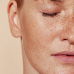 Is Pigmentation Treatment Effective for Uneven Skin Tone