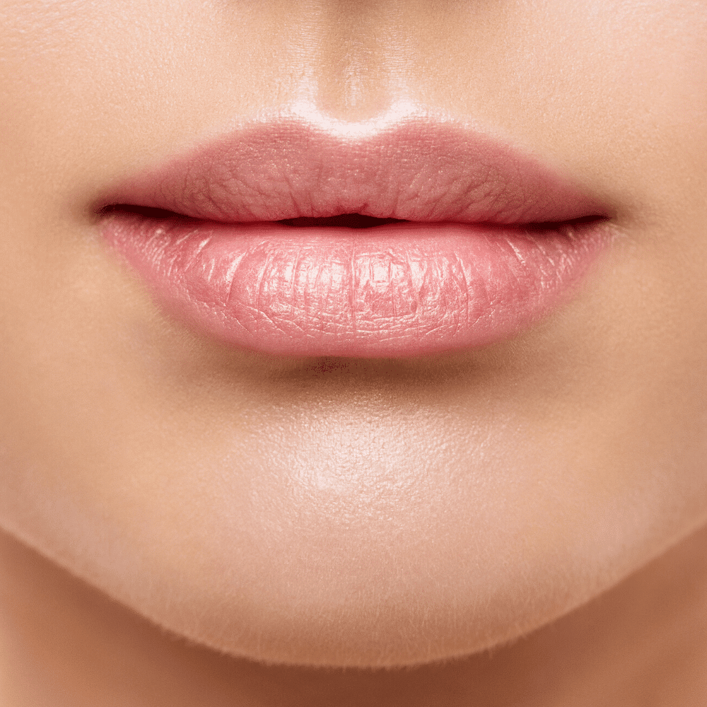 Natural Volume Enhancement with Lip Fillers